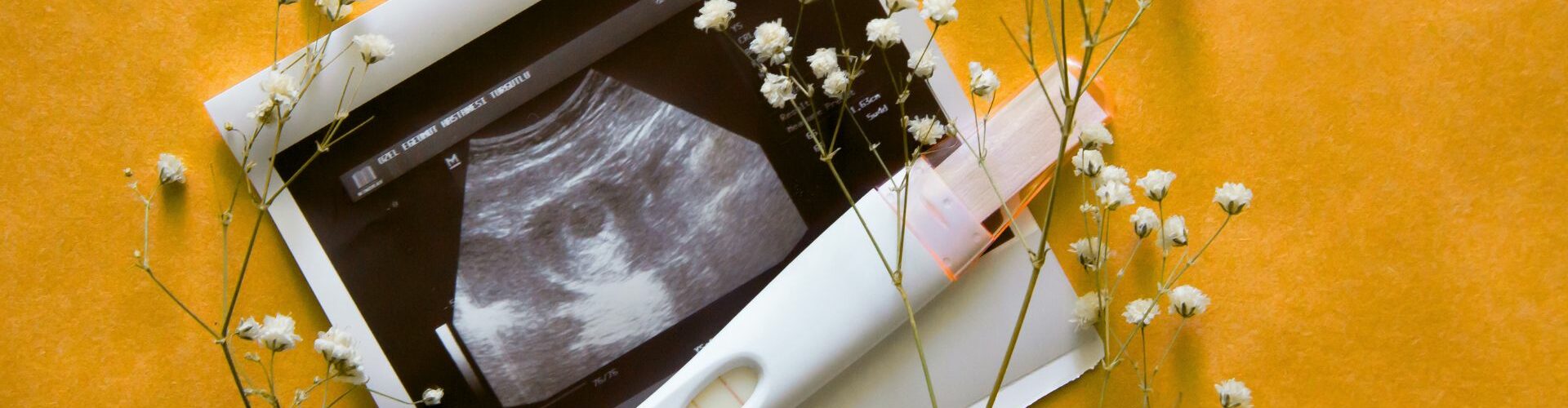 progesterone is a key hormone during pregnancy