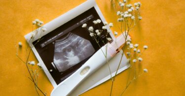 progesterone is a key hormone during pregnancy